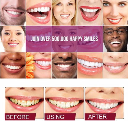 Probiotic Brightening Toothpaste™