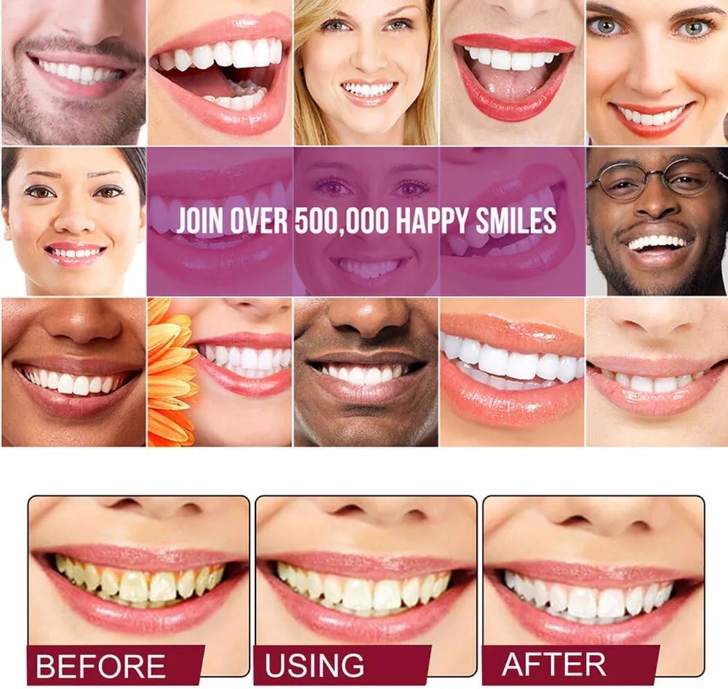 Probiotic Brightening Toothpaste™