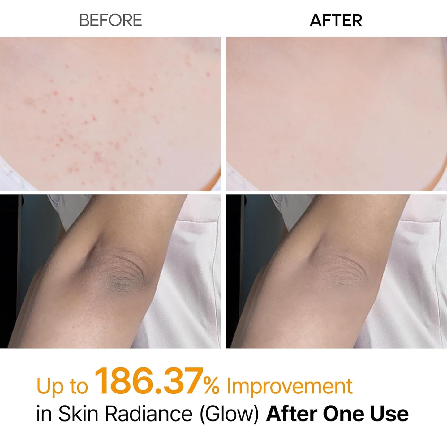 RadiantGlow Exfoliating Spray™