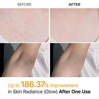 RadiantGlow Exfoliating Spray™